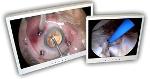 Video-, Endoskope-, Bronchoskop-Betrachtungsmonitore mit versch. Konfigurationen